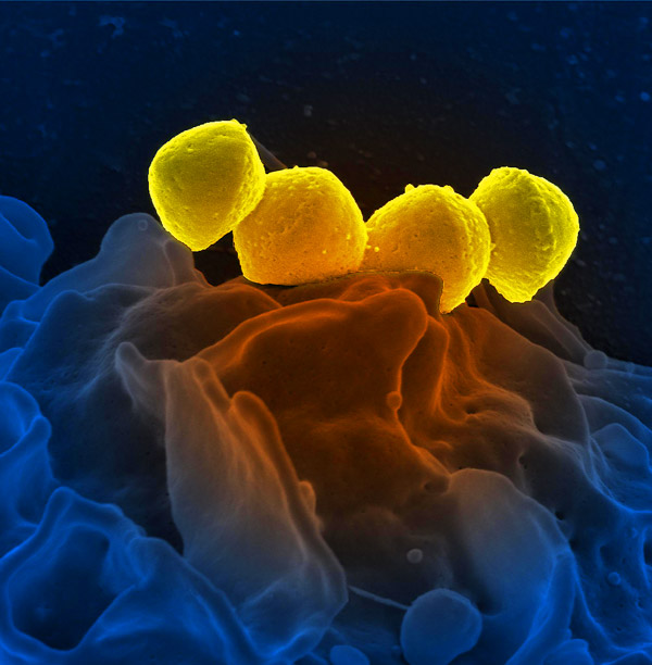 Bilan des signalements d’infection nosocomiale à <em>Streptococcus pyogenes</em> en France, 2012-2020
