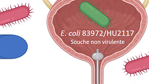 hy_xxxiii_3_bouiller