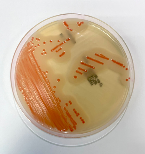 Cassier-Bacillus